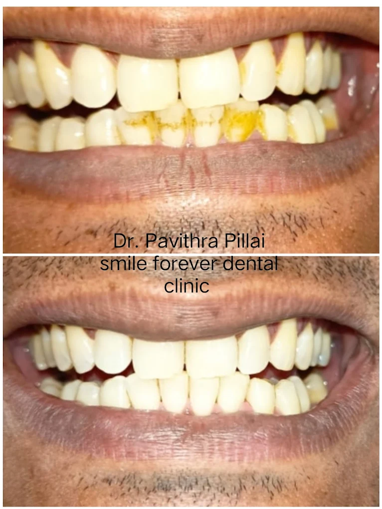 Dental Treatment